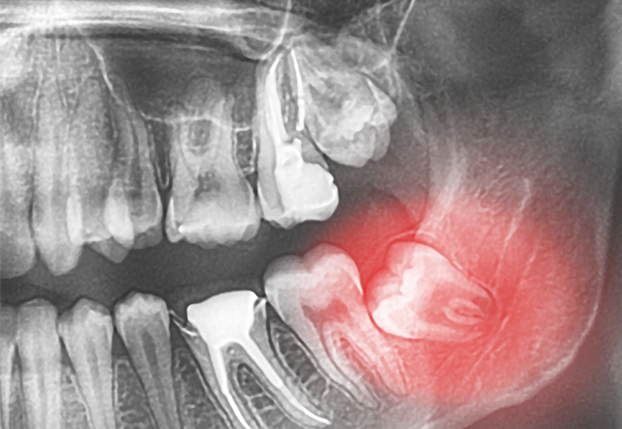 Treatment - brixtonsmiles