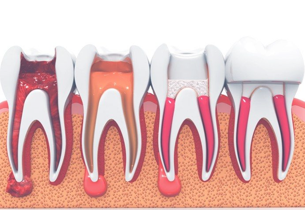 Treatment - brixtonsmiles