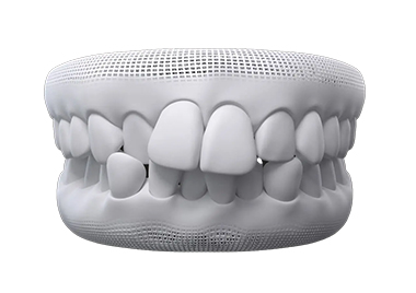 A condition that can be treated by an Invisalign provider near Camberwell