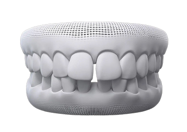 A condition that can be treated by an Invisalign provider near Camberwell