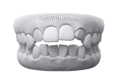 A condition that can be treated by an Invisalign provider near Camberwell