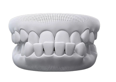 A condition that can be treated by an Invisalign provider near Camberwell
