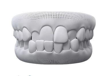 A condition that can be treated by an Invisalign provider near Camberwell